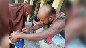 শিশুকে ক্যাপসুল খাওয়ালেন কৃষক, স্বাস্থ্য সহকারীকে শোকজ