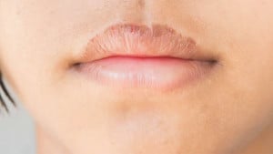 বারবার ঠোঁট ফাটছে? মেনে চলুন ঘরোয়া উপায়