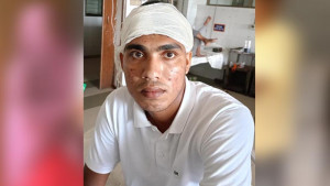 পাখি শিকারের প্রতিবাদ করায় যুবকের কপালে গুলি, থানায় মামলা