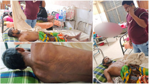 সিরাজগঞ্জে ডিবি হেফাজতে আসামির মৃত্যু, পুলিশের দাবি ‘শ্বাসকষ্ট’