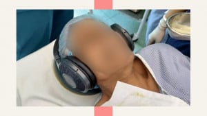 অস্ত্রোপচারে সঙ্গীতের ব্যবহারে ওষুধ লাগে কম: গবেষণার তথ্য