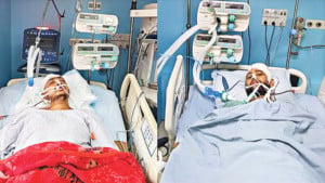 আহত দুই শিক্ষার্থী লাইফ সাপোর্টে