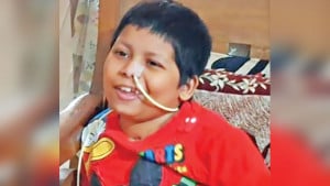 কৃত্রিম খুলি নিয়ে শিশু মুসার  লড়াই