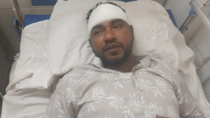 ভাঙ্গায় জামায়াত নেতাকে কুপিয়ে জখম