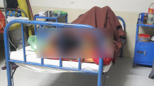 ঝিনাইদহে নারীকে তুলে নিয়ে শারীরিক নির্যাতন, হাসপাতালে ভর্তি