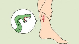 সাপের কামড়ে দুজনের মৃত্যু, চিকিৎসাধীন ৩