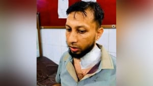 ডাকাত দলের হামলায় আহত মুরাদনগরের এসিল্যান্ড