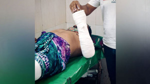 চাঁদা না পেয়ে ব্যবসায়ীর হাত-পা ভেঙে দিলেন শ্রমিক দল নেতা