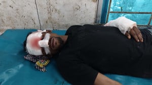 কোটালীপাড়ায় হাসপাতালে ঢুকে চিকিৎসাধীন যুবককে কুপিয়ে জখম