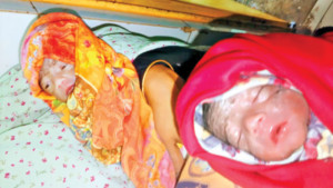 জন্মের পরই যমজ শিশুর শরীরে  অ্যান্টিবায়োটিক অকার্যকর