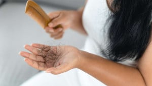 মাত্রাতিরিক্ত চুল পড়ছে? ডায়েটে রাখুন ৫ খাবার