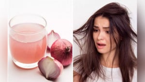 পেঁয়াজের রস ব্যবহারে কি চুল পড়া কমে? 