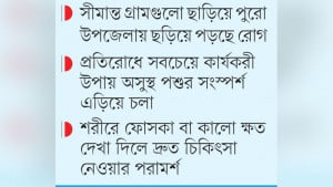 দৌলতপুরে ছড়াচ্ছে অ্যানথ্রাক্স  ২৩ দিনে ৪৭ রোগী শনাক্ত