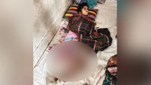 গৃহকর্মীর শরীরজুড়ে খুন্তির ছ্যাঁকা, মাথায় গুরুতর আঘাত