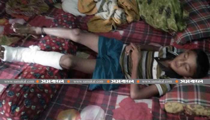 ‘দুষ্টুমি করায়’ শিশু শিক্ষার্থীর পা ভেঙে দিলেন শিক্ষক