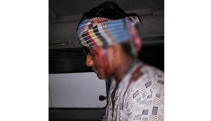 রাবিতে পিটিয়ে শিক্ষার্থীর মাথা ফাটানোর অভিযোগ ছাত্রলীগ কর্মীদের বিরুদ্ধে
