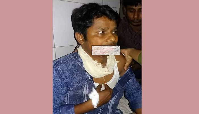 কামড়ে শিক্ষকের ঠোঁট ছিঁড়ে ফেললেন আরেক শিক্ষক