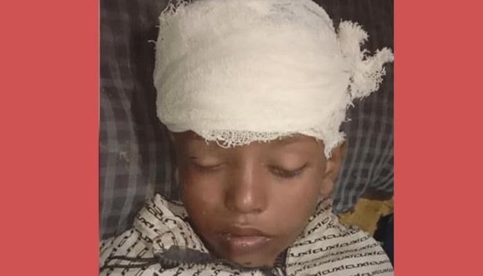 ৭ দিনেও মেলেনি আহত শিশুর পরিচয়