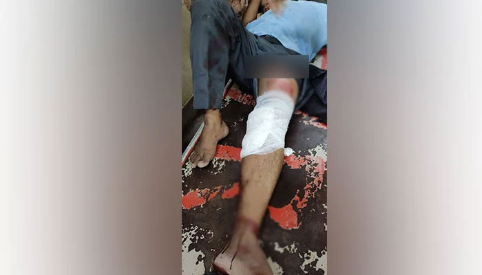 বাস থেকে ফেলে দেওয়া শিক্ষকের চিকিৎসা চলছে