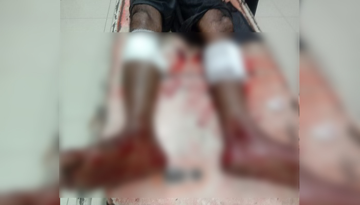 পরিবহন শ্রমিককে পিটিয়ে হাত-পা ভেঙে দেওয়ার অভিযোগ